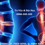 Điều trị gai cột sống uy tín tại Cần Thơ 17 gai cột sống là căn bệnh gây nhiều khó khăn trong sinh hoạt