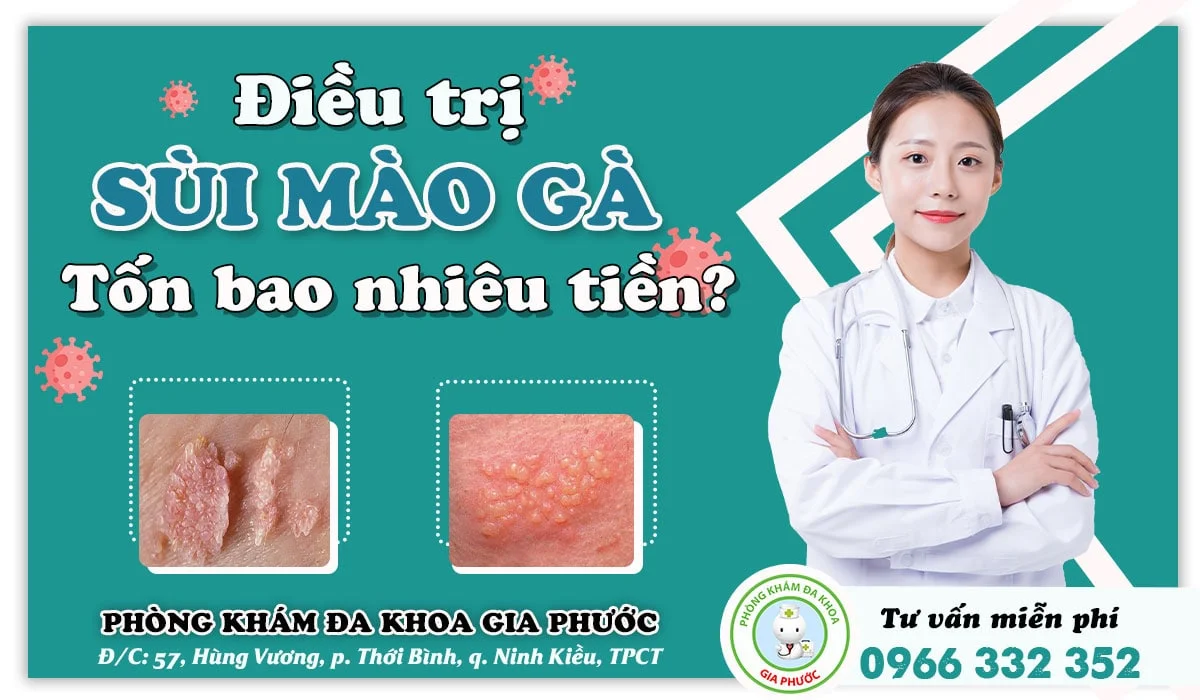 CHI PHÍ KHÁM SÙI MÀO GÀ TẠI BỆNH VIỆN CHUYÊN KHOA DA LIỄU HÀNG ĐẦU
