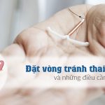Đặt Vòng Tránh Thai Đúng Cách Và Những Điều Cần Biết