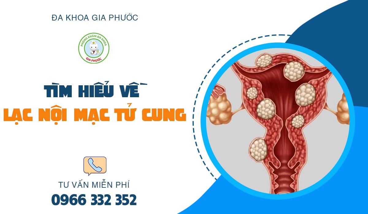 nguyên nhân gây lạc nội mạc tử cung