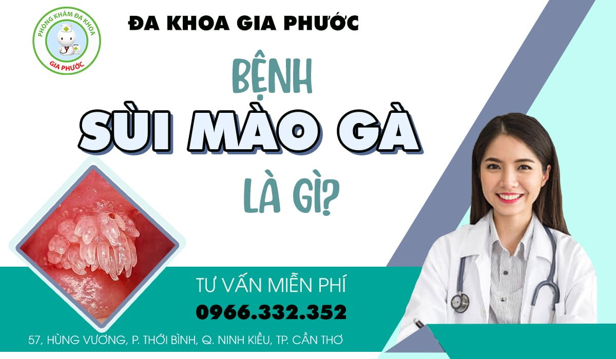 Bệnh sùi mào gà là gì?