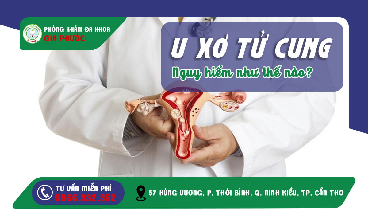 Chi Phí Điều Trị U Xơ Tử Cung Bao Nhiêu ? 25 Bệnh u xơ tử cung có nguy hiểm không?