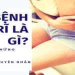 Bệnh trĩ - Nguyên nhân biến chứng và phương pháp hỗ trợ điều trị 14 tri la gi avatar 900x450