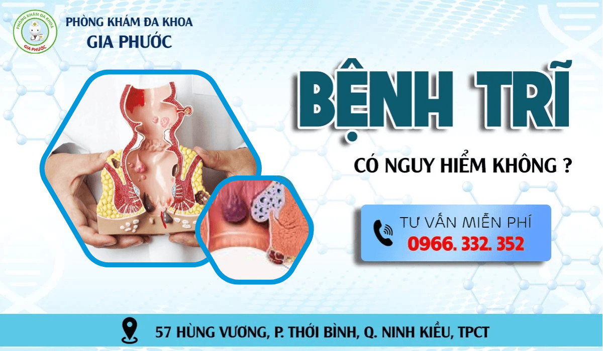 Địa Chỉ Chữa Bệnh Trĩ Ngoại 15 Bệnh trĩ có nguy hiểm không Nên chữa trị bệnh trĩ ở đâu (1)