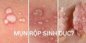 avatar mun rop sinh duc