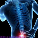 Điều Trị Bệnh Gai cột Sống Trong Việc Sử Dụng Một Số Bài Thuốc Nam 20 Bệnh gai cột sống có nguy hiểm không?