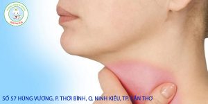 Bệnh lý viêm amidan dễ tái phát vào mùa lạnh