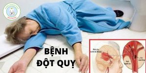 benh dot quy