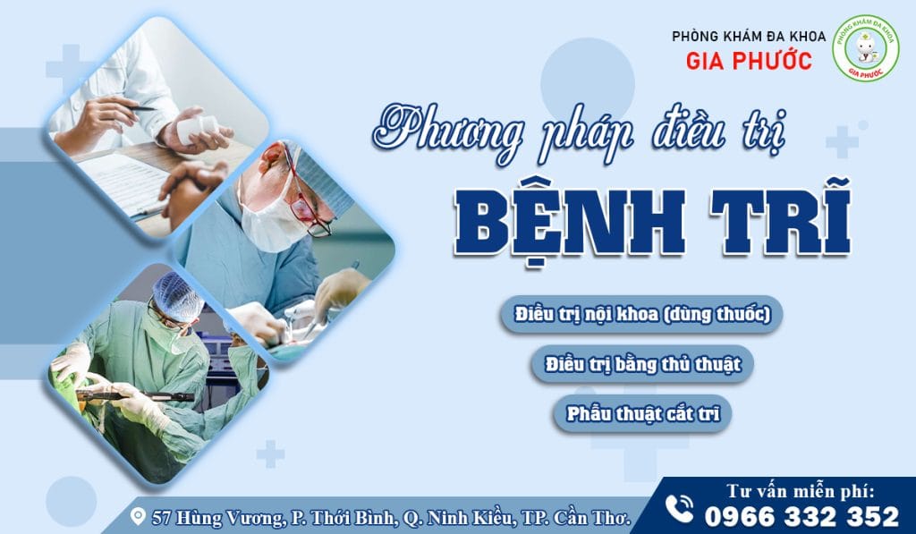 Tùy theo tình trạng bệnh thực tế, sau thăm khám bác sĩ chuyên khoa sẽ chỉ định áp dụng phương pháp chữa trĩ phù hợp