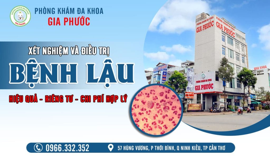Phương pháp hỗ trợ điều trị bệnh lậu hiệu quả 20 Xét nghiệm và hỗ trợ điều trị bệnh lậu hiệu quả tại phòng khám đa khoa Gia Phước