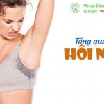Tổng quan về hôi nách