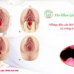 Những điều cần biết khi thực hiện thủ thuật vá màng trinh 7 Những điều cần biết khi thực hiện thủ thuật vá màng trinh