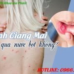 Bệnh giang mai có lây qua nước bọt không
