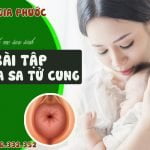 Bật mí cho mẹ sau sinh 4 bài tập chữa sa tử cung hiệu quả 14 bài tập chữa sa tử cung