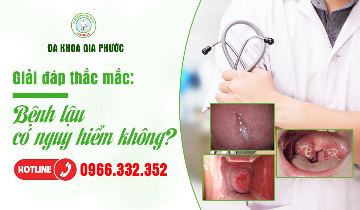 Bệnh lậu có nguy hiểm không