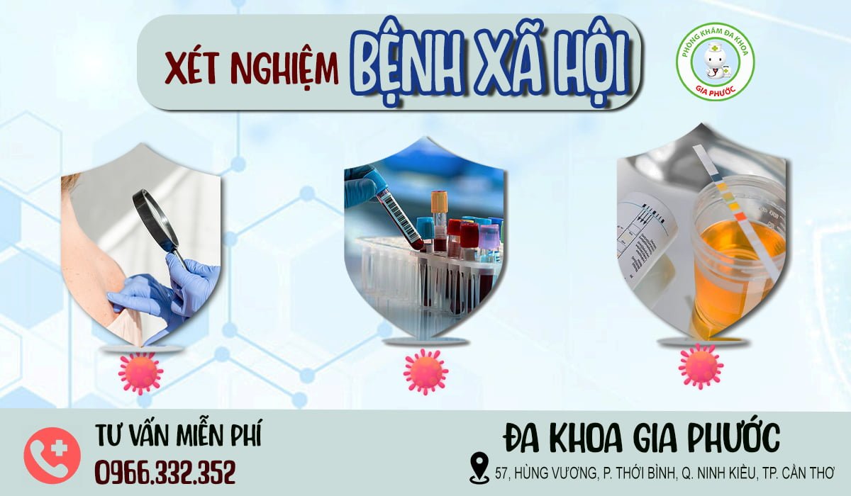 Xét nghiệm và khám bệnh xã hội ở đâu tốt nhất? 10 xét nghiệm và khám bệnh xã hội