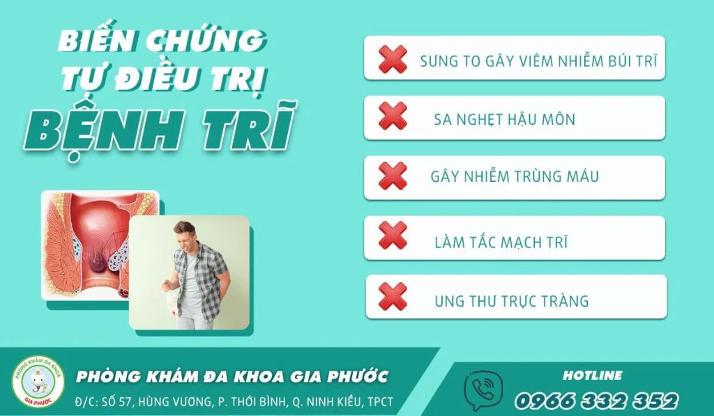 Chữa trị bệnh trĩ tại nhà dễ gây ra những biến chứng nguy hiểm