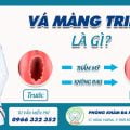 Phương pháp vá màng trinh thẩm mỹ, chuẩn y khoa tại Cần Thơ 32 vá màng trinh là gì