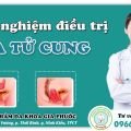 Kinh nghiệm chữa sa tử cung đơn giản hiệu quả