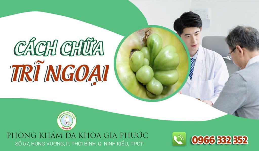 cách chữa bệnh trĩ ngoại
