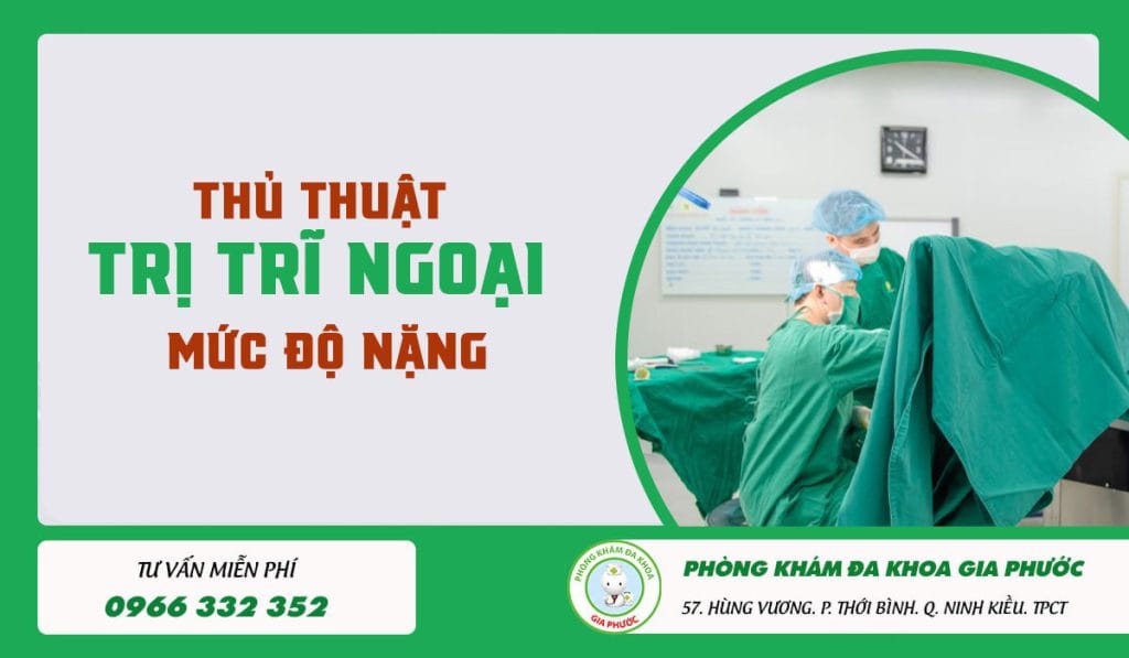 Các biện pháp thủ thuật, phẫu thuật được áp dụng trong trường hợp trĩ ngoại ở mức độ nặng