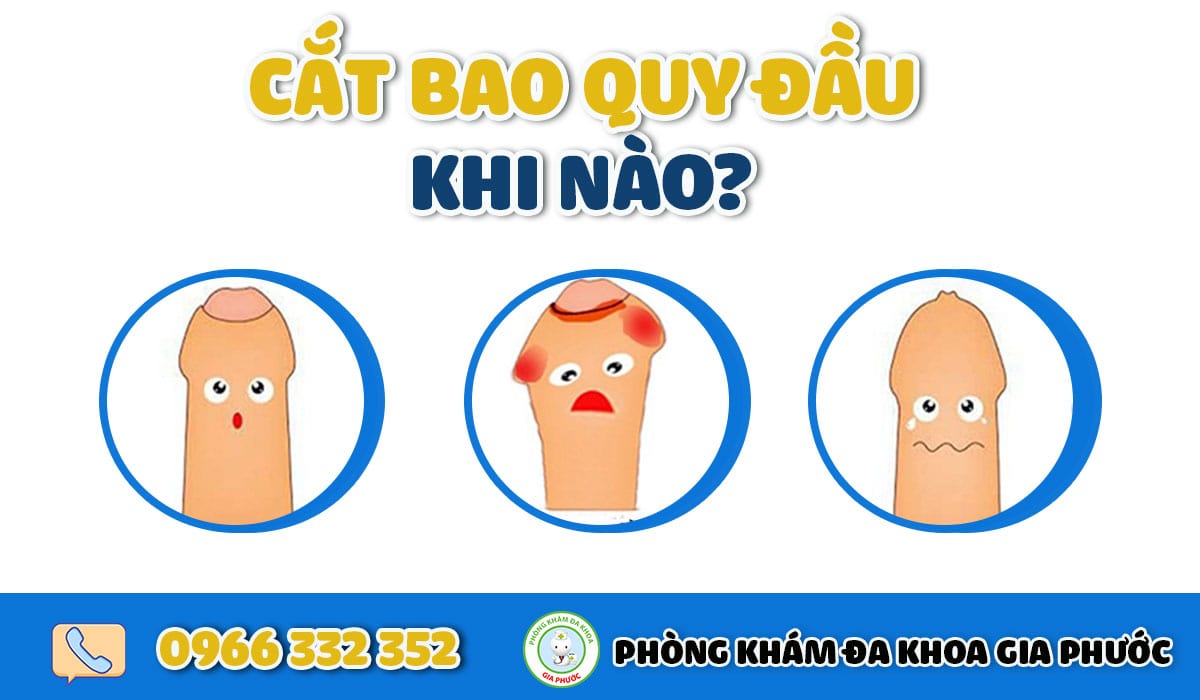 Khi nào cần cắt bao quy đầu?