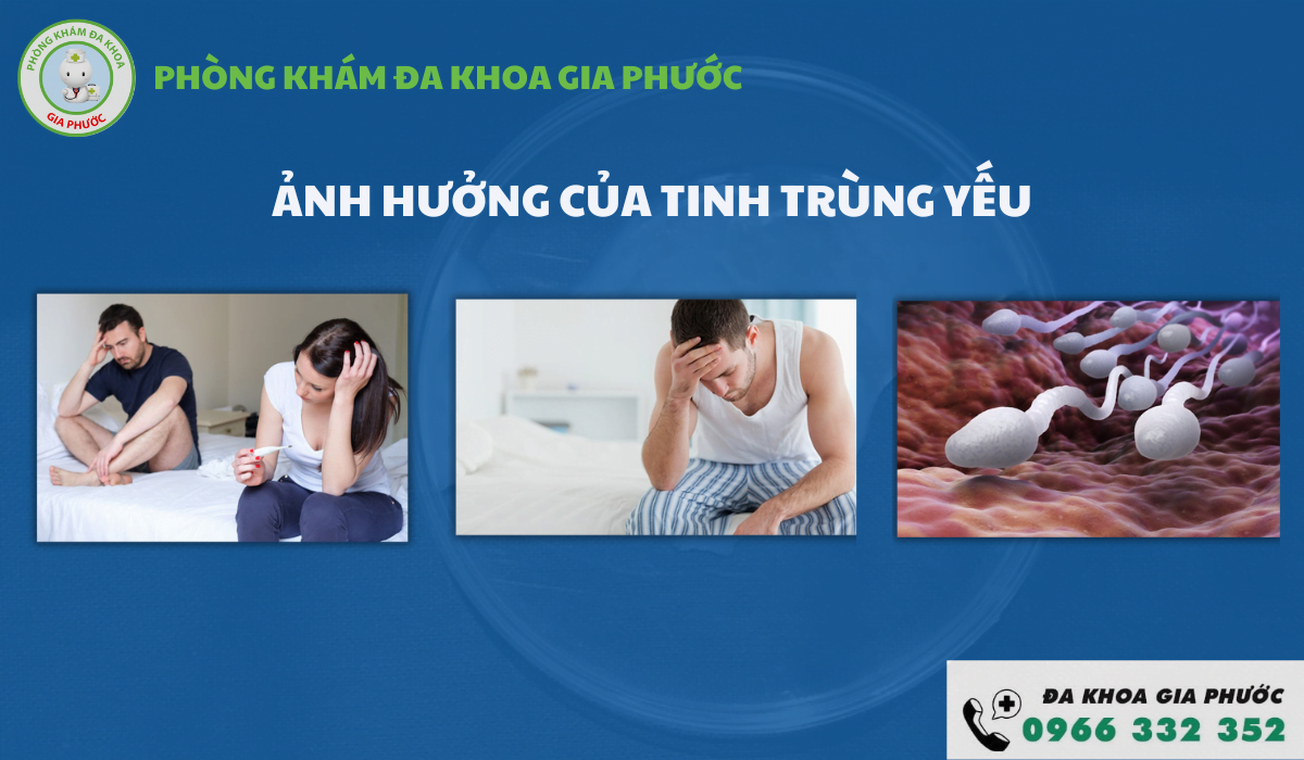 chi phí điều trị tinh trùng yếu tại Cần Thơ