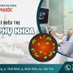 Chi phí điều trị viêm phụ khoa tại Cần Thơ