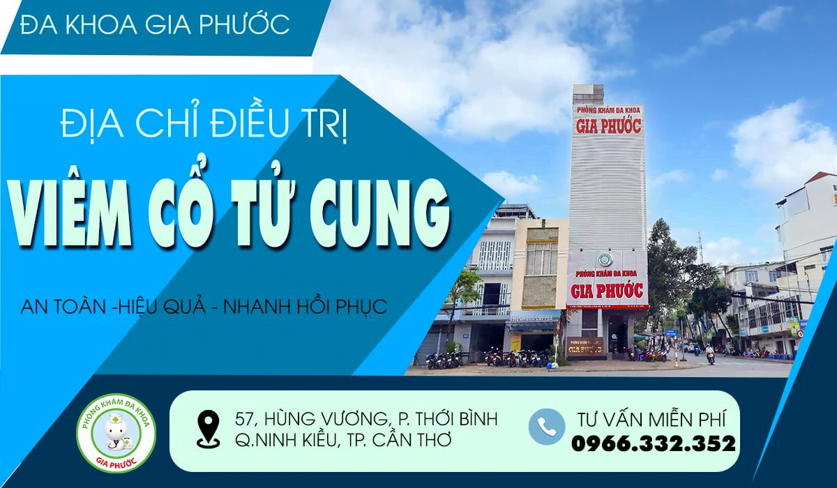 Chi phí điều trị viêm cổ tử cung tại cần thơ