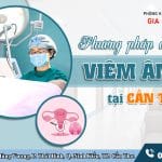 Phương Pháp Điều Trị Viêm Âm Hộ Tại Cần Thơ 10 Phương pháp điều trị viêm âm hộ hiệu quả