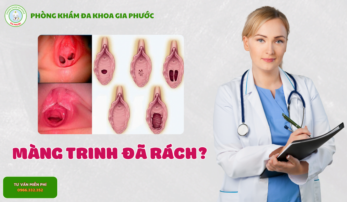 Màng trinh đã rách? Tìm lại sự tự tin với dịch vụ vá màng trinh tại Phòng khám Đa khoa Gia Phước 11 Màng trinh đã rách?
