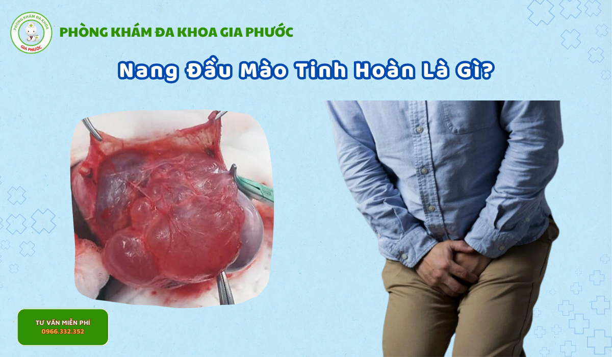 Nang đầu mào tinh hoàn