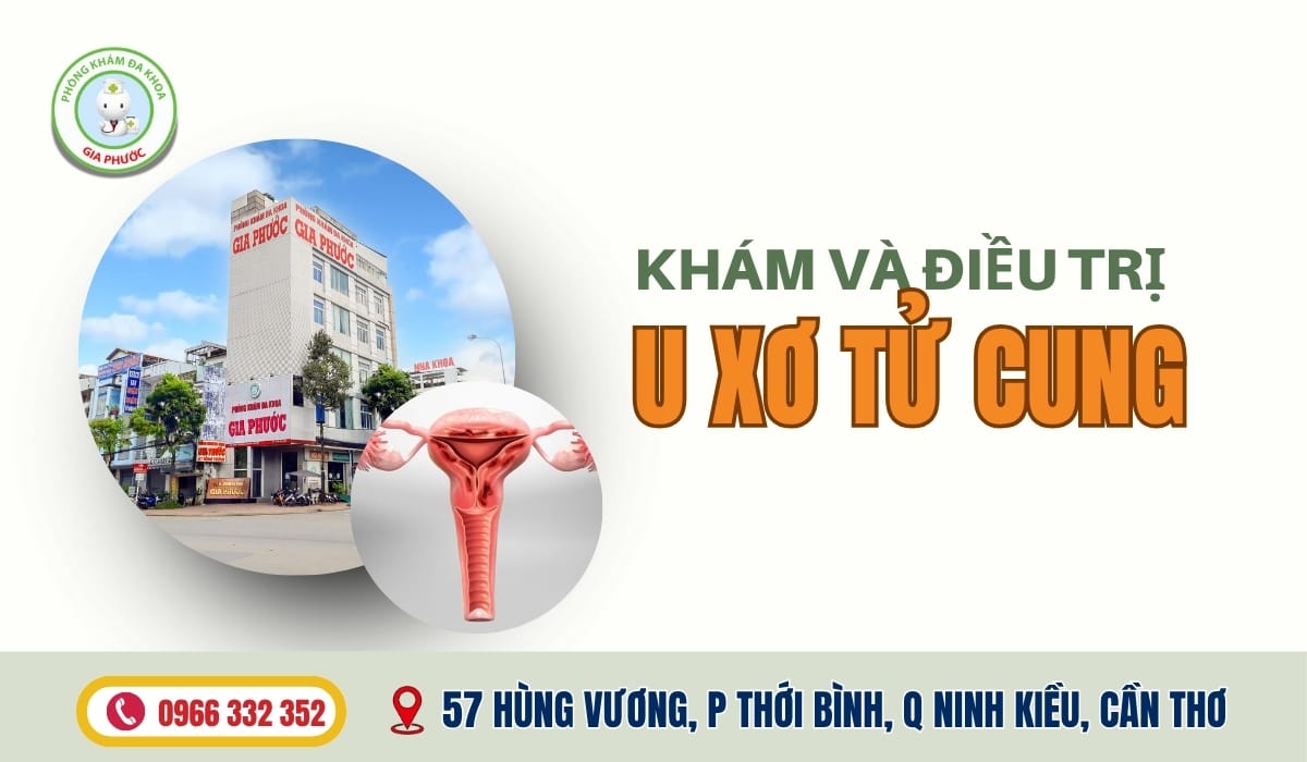 Điều Trị U Xơ Tử Cung Ở Đâu Khám và điều trị u xơ tử cung