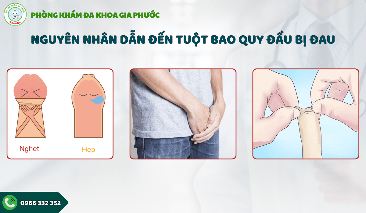 Tuột bao quy đầu bị đau phải làm sao?