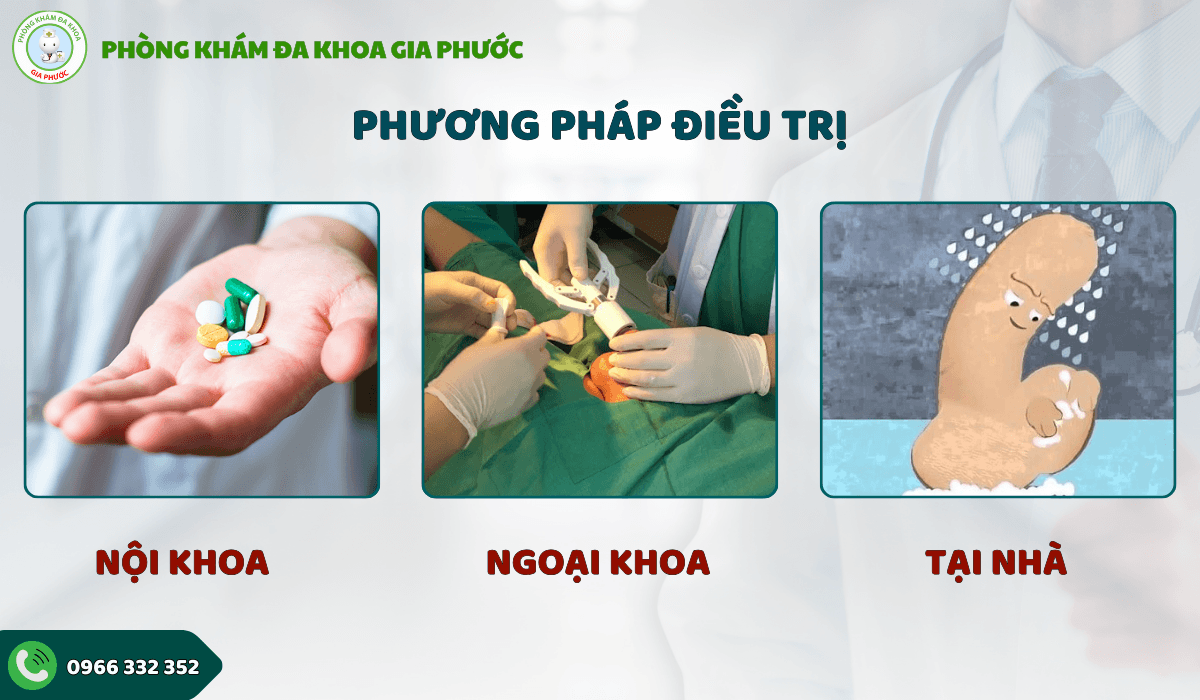 Tuột bao quy đầu bị đau phải làm sao?