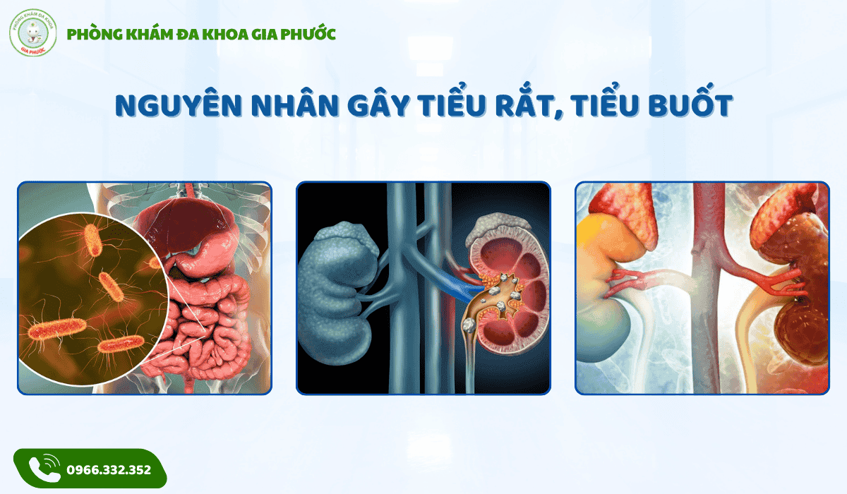 Đa Khoa Gia Phước - Điều Trị Tiểu Rắt Tiểu Buốt Tại Cần Thơ - Phòng ...