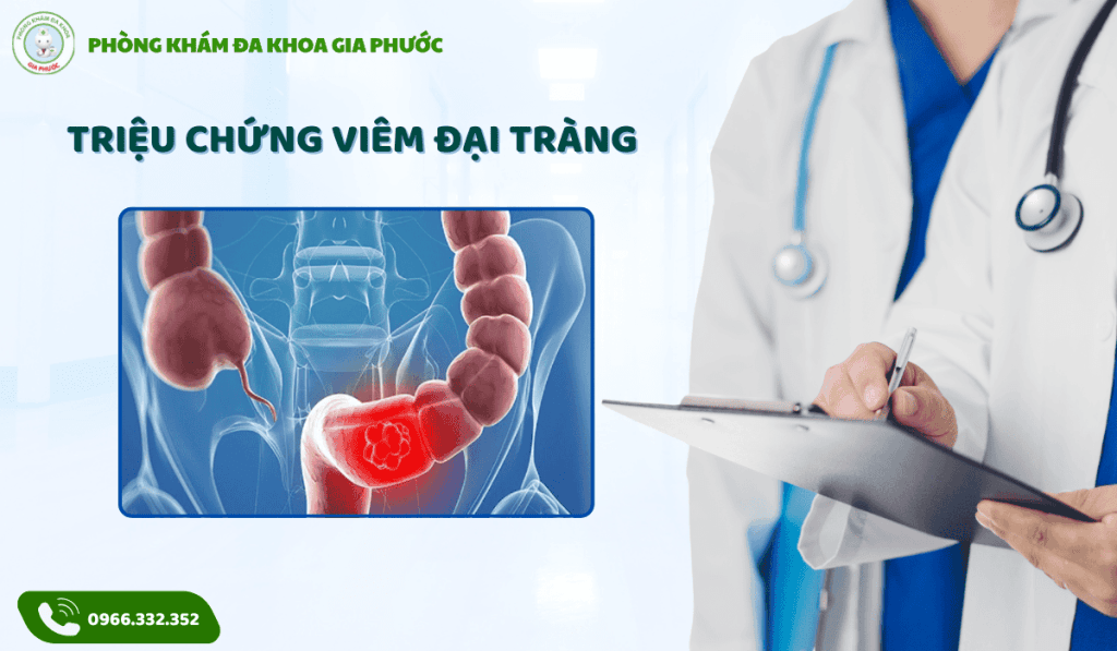 Chi phí điều trị viêm đại tràng tại cần thơ