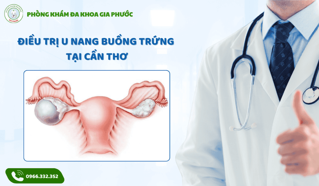 Điều trị u nang buồng trứng tại cần thơ