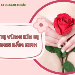 Cách Trị Vùng Kín Bị Thâm Đen Bẩm Sinh: Giải Pháp Cho Nàng Tự Tin 13 Cách trị vùng kín bị thâm đen bẩm sinh