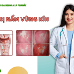 Điều Trị Nấm Vùng Kín Tại Cần Thơ: Phòng Khám Đa Khoa Gia Phước – Uy Tín và Hiệu Quả 11 Điều trị nấm vùng kín tại cần thơ
