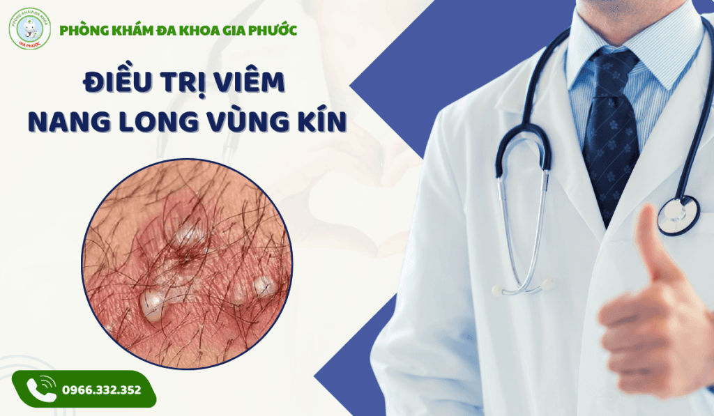 Điều trị viêm nang lông vùng kín tại cần thơ