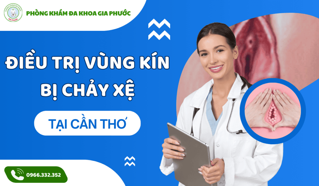 Điều trị vùng kín bị chảy xệ tại cần thơ