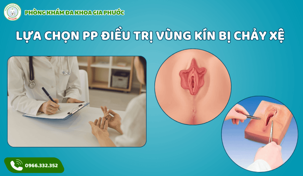 Điều Trị Vùng Kín Bị Chảy Xệ Tại Cần Thơ: Giải Pháp Cho Sự Tự Tin Và Hạnh Phúc 3 Điều trị vùng kín bị chảy xệ tại cần thơ