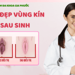 Làm Đẹp Vùng Kín Sau Sinh: Bí Quyết Phục Hồi Tự Tin Và Hạnh Phúc 9 Làm đẹp vùng kín sau sinh
