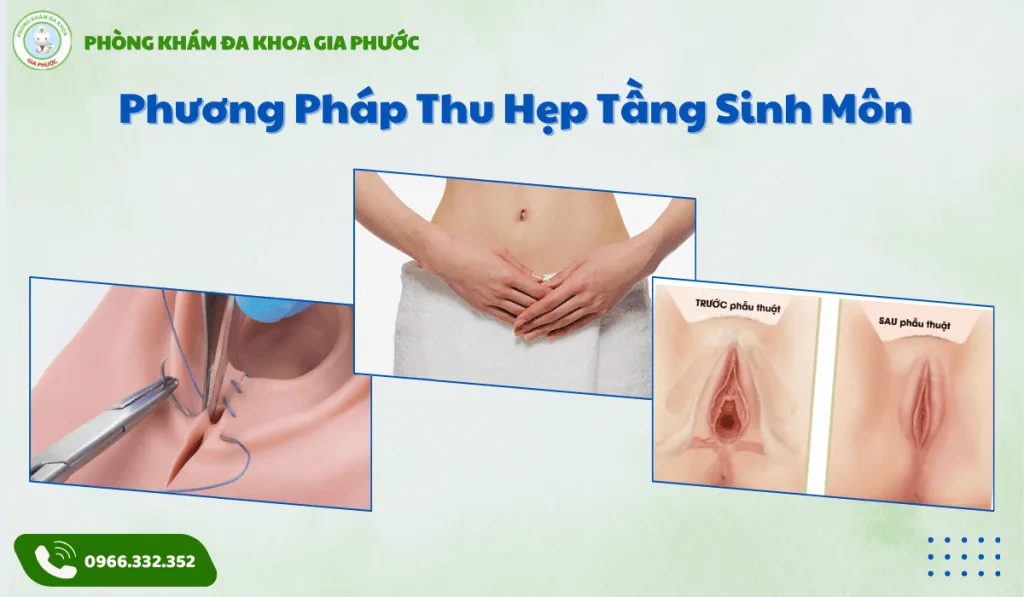 VIDEO MÔ PHỎNG KỸ THUẬT MAY THẨM MỸ TẦNG SINH MÔN HIỆN ĐẠI