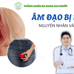 Âm đạo bị rộng: Nguyên nhân, dấu hiệu và cách khắc phục hiệu quả 22 Âm đạo bị rộng