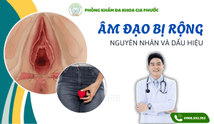 Âm đạo bị rộng: Nguyên nhân, dấu hiệu và cách khắc phục hiệu quả 1 Âm đạo bị rộng