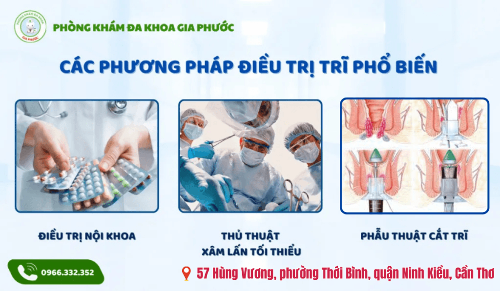 Các Phương Pháp Chữa Trị Trĩ Phổ Biến Tại Các Cơ Sở Y Tế Uy Tín