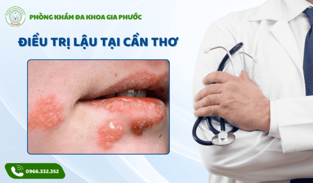 Điều trị lậu tại cần thơ