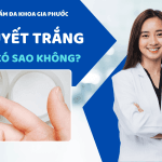 Ra huyết trắng nhiều có sao không